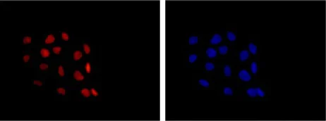 Immunocytochemistry/ Immunofluorescence - Anti-p63 antibody [Y289] (AB32353)