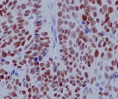 Anti-p63 antibody [Y289]