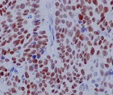 Immunohistochemistry (Formalin/PFA-fixed paraffin-embedded sections) - Anti-p63 antibody [Y289] (AB32353)
