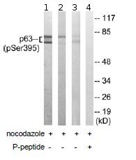 Western blot - Anti-p63 (phospho S395) antibody (AB92581), expandable thumbnail