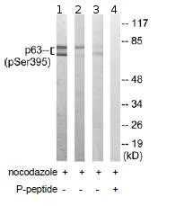 Western blot - Anti-p63 (phospho S395) antibody (AB92581)