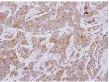 Immunohistochemistry (Formalin/PFA-fixed paraffin-embedded sections) - Anti-p63RhoGEF antibody (AB127690)