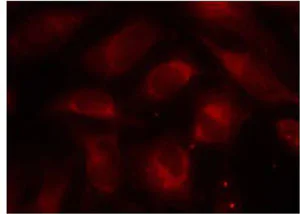 Immunocytochemistry/ Immunofluorescence - Anti-P70 S6 Kinase beta/SRK antibody (AB131526)