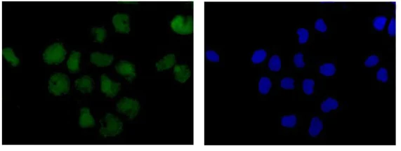Immunocytochemistry/ Immunofluorescence - Anti-P70 S6 Kinase beta/SRK antibody [EPR14956] - BSA and Azide free (AB250753)