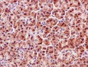 Immunohistochemistry (Formalin/PFA-fixed paraffin-embedded sections) - Anti-P70 S6 Kinase beta/SRK antibody [EPR14956] - BSA and Azide free (AB250753)