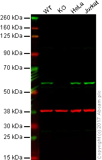 Western blot - Anti-P70 S6 Kinase beta/SRK antibody [EPR14956] - BSA and Azide free (AB250753)