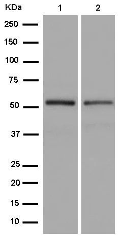 Western blot - Anti-P70 S6 Kinase beta/SRK antibody [EPR14956] - BSA and Azide free (AB250753)