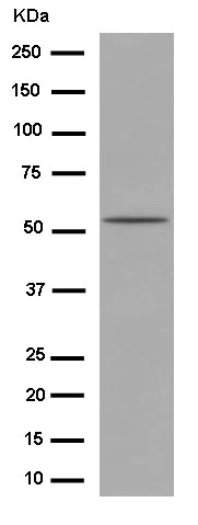 Western blot - Anti-P70 S6 Kinase beta/SRK antibody [EPR14956] - BSA and Azide free (AB250753)