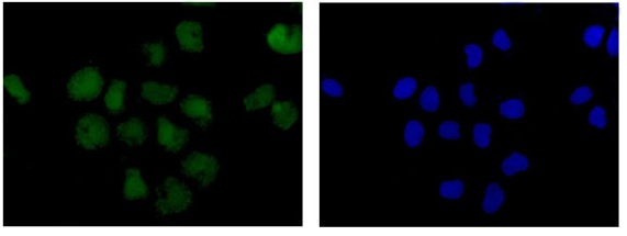 Anti-P70 S6 Kinase beta/SRK antibody [EPR14956] - N-terminal