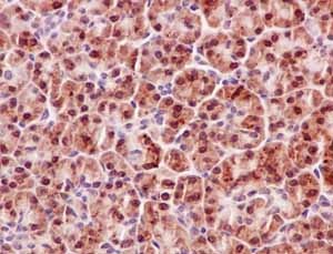 Anti-P70 S6 Kinase beta/SRK antibody [EPR14956] - N-terminal