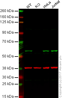 Western blot - Anti-P70 S6 Kinase beta/SRK antibody [EPR14956] - N-terminal (AB184551), expandable thumbnail