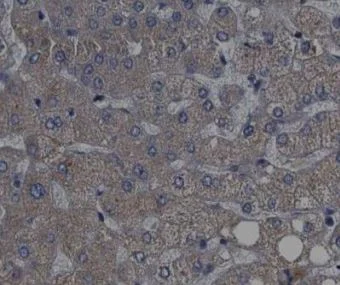 Immunohistochemistry (Formalin/PFA-fixed paraffin-embedded sections) - Anti-P70 S6 Kinase (phospho T389) antibody (AB2571)