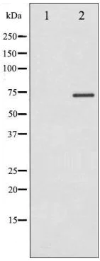 Western blot - Anti-P70 S6 Kinase (phospho T389) antibody (AB2571)