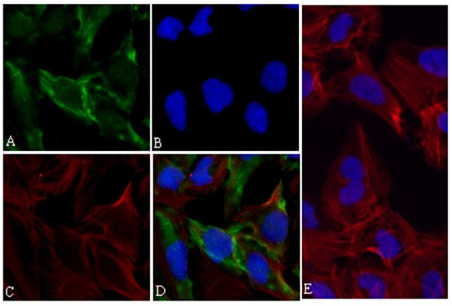Immunocytochemistry/ Immunofluorescence - Anti-p70 S6 Kinase (phospho T421 + S424) antibody [RP23040018] (AB308099), expandable thumbnail