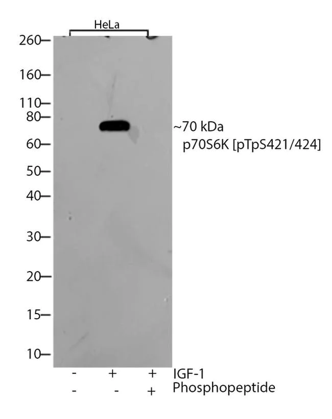 Western blot - Anti-p70 S6 Kinase (phospho T421 + S424) antibody [RP23040018] (AB308099)