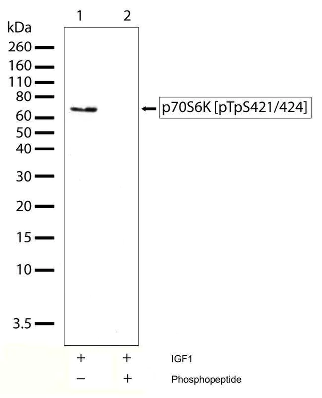 Western blot - Anti-p70 S6 Kinase (phospho T421 + S424) antibody [RP23040018] (AB308099)