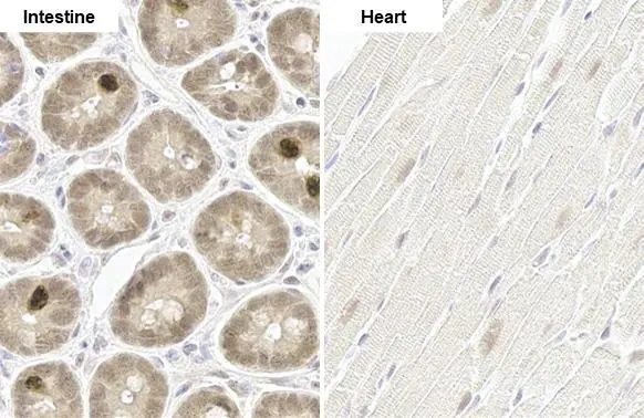 Immunohistochemistry paraffin embedded sections - Anti-p70 S6K phospho Thr421 Ser424 antibody [HL129] (AB308331), expandable thumbnail