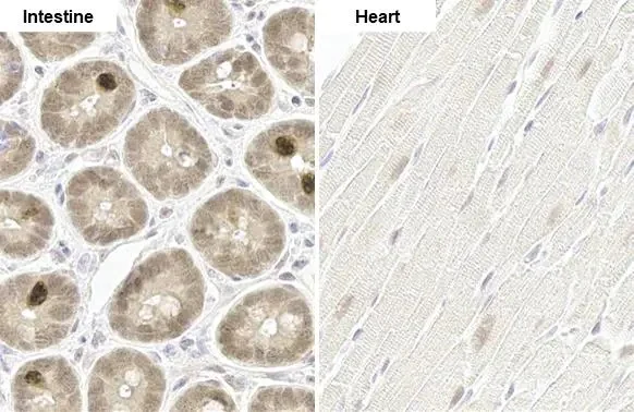 Immunohistochemistry paraffin embedded sections - Anti-p70 S6K phospho Thr421 Ser424 antibody [HL129] (AB308331)
