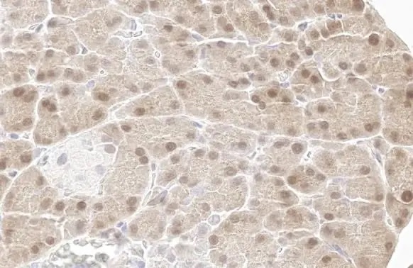 Immunohistochemistry paraffin embedded sections - Anti-p70 S6K phospho Thr421 Ser424 antibody [HL129] (AB308331), expandable thumbnail
