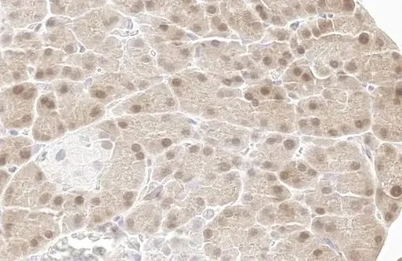 Immunohistochemistry paraffin embedded sections - Anti-p70 S6K phospho Thr421 Ser424 antibody [HL129] (AB308331)