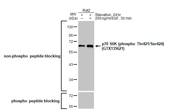 Western blot - Anti-p70 S6K phospho Thr421 Ser424 antibody [HL129] (ab308331), expandable thumbnail