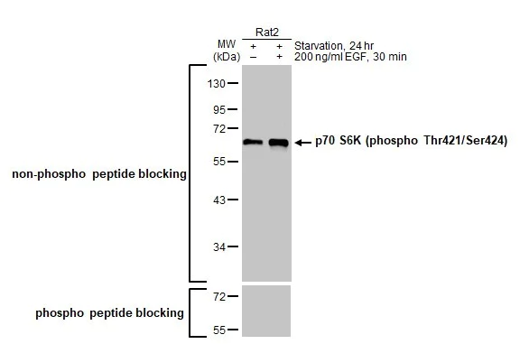 Western blot - Anti-p70 S6K phospho Thr421 Ser424 antibody [HL129] (AB308331)