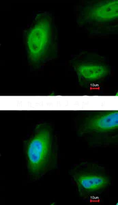 Immunocytochemistry/ Immunofluorescence - Anti-p73 antibody (AB137797)