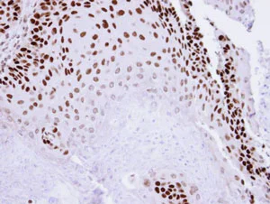 Immunohistochemistry (Formalin/PFA-fixed paraffin-embedded sections) - Anti-p73 antibody (AB137797)