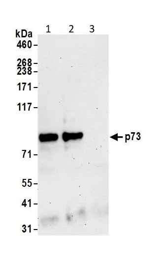 Immunoprecipitation - Anti-p73 antibody (AB14430)
