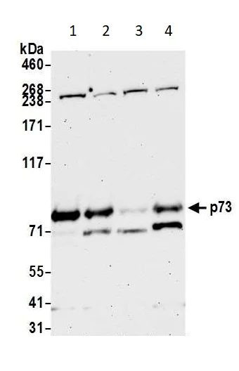 Western blot - Anti-p73 antibody (AB14430)