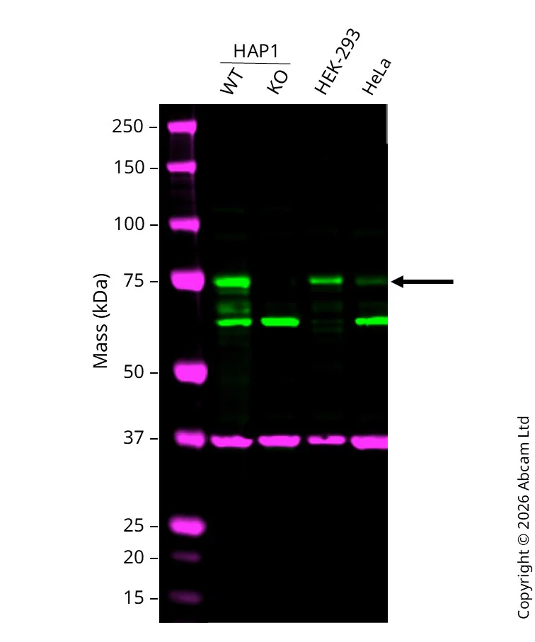 Western blot - Anti-p73 antibody [EP436Y] (AB40658)