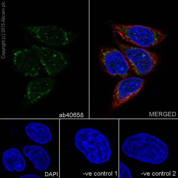 Immunocytochemistry/ Immunofluorescence - Anti-p73 antibody [EP436Y] - BSA and Azide free (AB219594)