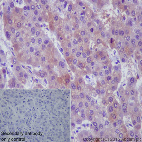 Immunohistochemistry (Formalin/PFA-fixed paraffin-embedded sections) - Anti-p73 antibody [EP436Y] - BSA and Azide free (AB219594)