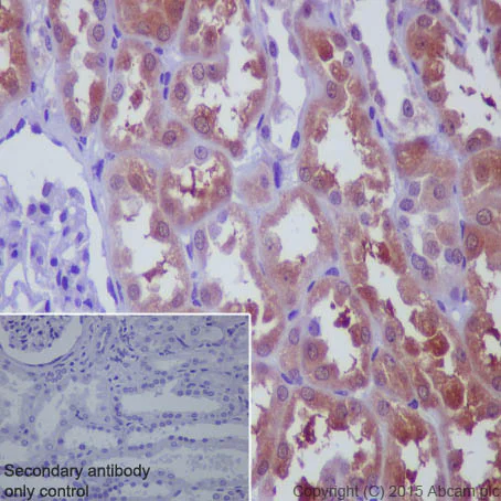 Immunohistochemistry (Formalin/PFA-fixed paraffin-embedded sections) - Anti-p73 antibody [EP436Y] - BSA and Azide free (AB219594)