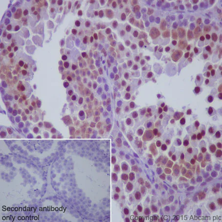 Immunohistochemistry (Formalin/PFA-fixed paraffin-embedded sections) - Anti-p73 antibody [EP436Y] - BSA and Azide free (AB219594)