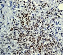 Immunohistochemistry (Formalin/PFA-fixed paraffin-embedded sections) - Anti-p73 antibody [EP436Y] - BSA and Azide free (AB219594)