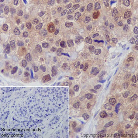 Immunohistochemistry (Formalin/PFA-fixed paraffin-embedded sections) - Anti-p73 antibody [EPR18409(T)(MIX)] (AB189896)