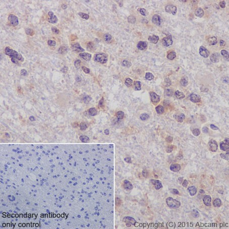 Immunohistochemistry (Formalin/PFA-fixed paraffin-embedded sections) - Anti-p73 antibody [EPR18409(T)(MIX)] (AB189896)
