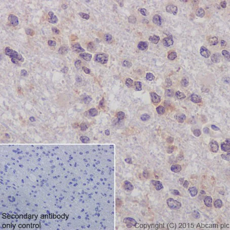 Immunohistochemistry (Formalin/PFA-fixed paraffin-embedded sections) - Anti-p73 antibody [EPR18409(T)(MIX)] (AB189896)
