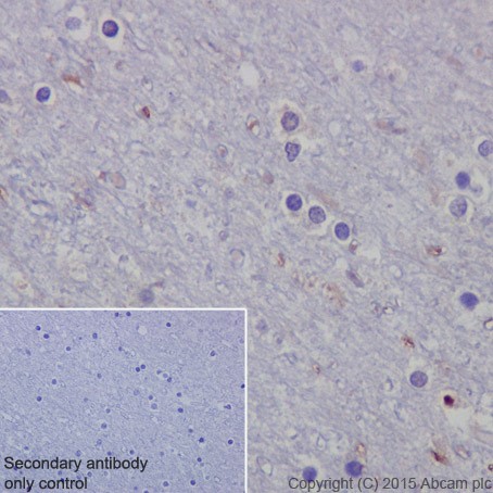 Immunohistochemistry (Formalin/PFA-fixed paraffin-embedded sections) - Anti-p73 antibody [EPR18409(T)(MIX)] (AB189896)