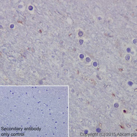 Immunohistochemistry (Formalin/PFA-fixed paraffin-embedded sections) - Anti-p73 antibody [EPR18409(T)(MIX)] (AB189896)
