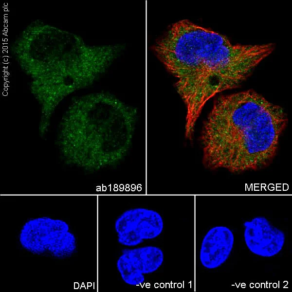 Immunocytochemistry/ Immunofluorescence - Anti-p73 antibody [EPR18409(T)(MIX)] - BSA and Azide free (AB250999)