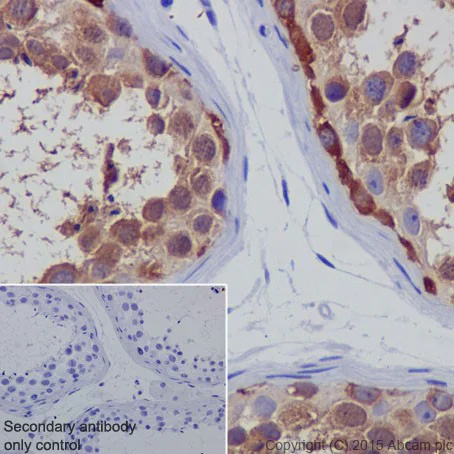 Immunohistochemistry (Formalin/PFA-fixed paraffin-embedded sections) - Anti-p73 antibody [EPR18409(T)(MIX)] - BSA and Azide free (AB250999)