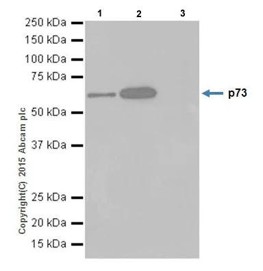 Immunoprecipitation - Anti-p73 antibody [EPR18409(T)(MIX)] - BSA and Azide free (AB250999)