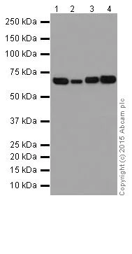Western blot - Anti-p73 antibody [EPR18409(T)(MIX)] - BSA and Azide free (AB250999)