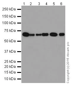 Western blot - Anti-p73 antibody [EPR18409(T)(MIX)] - BSA and Azide free (AB250999)