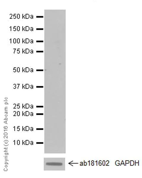 Western blot - Anti-p73 antibody [EPR19560] - BSA and Azide free (AB251374)