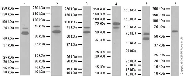 Western blot - Anti-p73 antibody [EPR19560] - BSA and Azide free (AB251374)