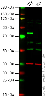 Western blot - Anti-p73 antibody [EPR19560] - BSA and Azide free (AB251374)