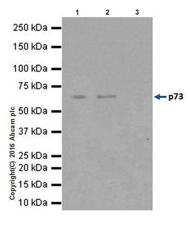 Immunoprecipitation - Anti-p73 antibody [EPR19560] - ChIP Grade (AB202474)
